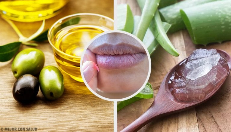 Cura tus labios quemados con estos 6 remedios naturales