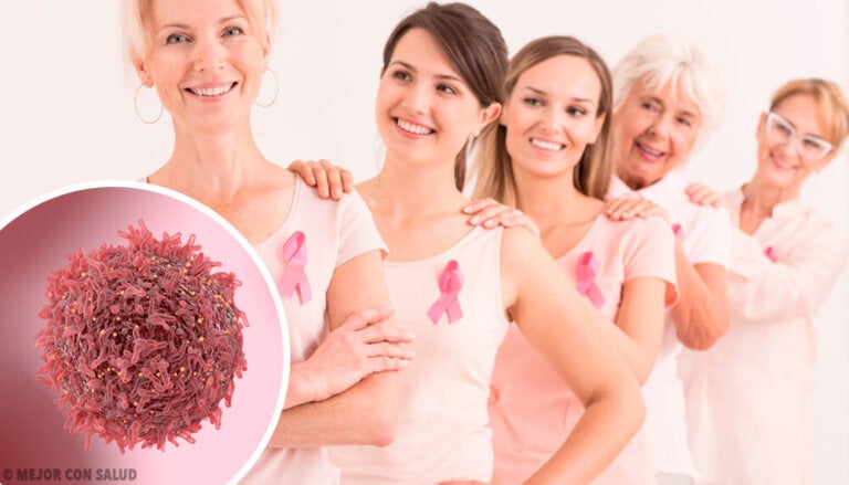El cáncer de mama triple negativo