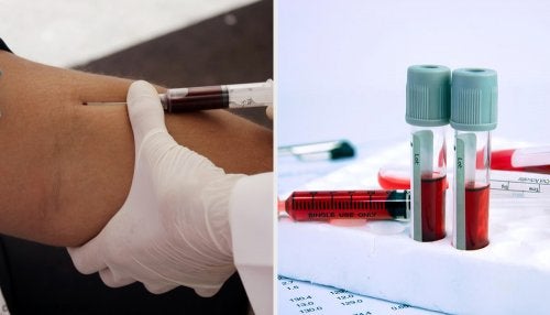 Entendiendo un análisis de sangre, te explicamos todos los parámetros