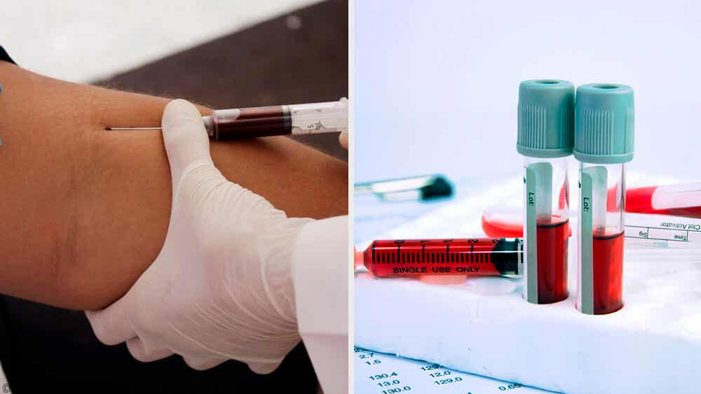 ¿Cuál es el procedimiento correcto para la extracción de sangre venosa? Mejor con Salud ¿Cuál es el procedimiento correcto para la extracción de sangre venosa? Mejor con Salud