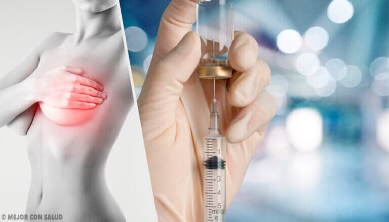 Fulvestrant: la segunda línea de tratamiento en el cáncer de mama