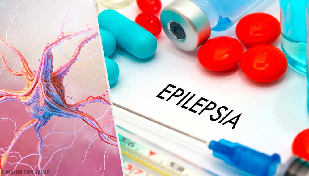 La vigabatrina en el tratamiento de la epilepsia