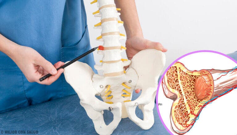 Tipos de osteogénesis imperfecta