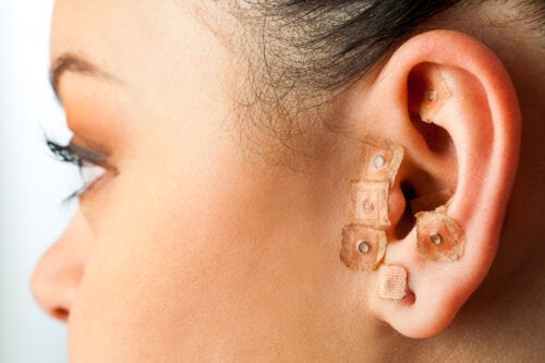 ¿En qué consiste la auriculoterapia?