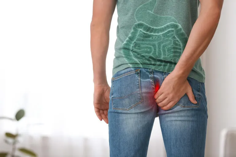 Hemorroides externas: todo lo que debes saber