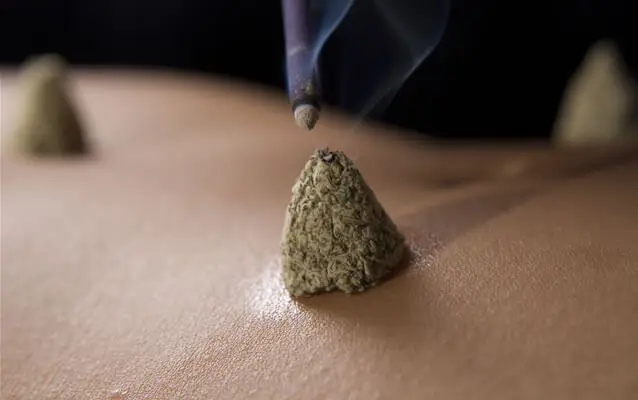 moxa