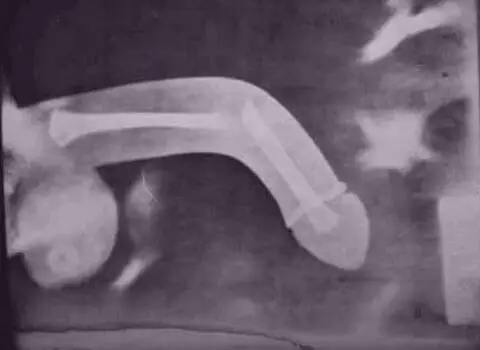 Posiciones sexuales peligrosas para el hombre.