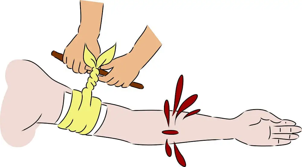 Torniquete en el brazo