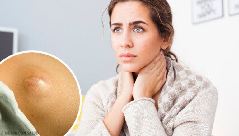 Lipoma: todo lo que debes saber