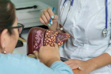 Hígado graso, la enfermedad silenciosa que puede derivar en cáncer