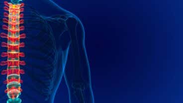 ¿Qué es un angioma vertebral? Causas, síntomas y tratamiento