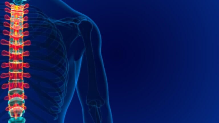 ¿Qué es un angioma vertebral? Causas, síntomas y tratamiento