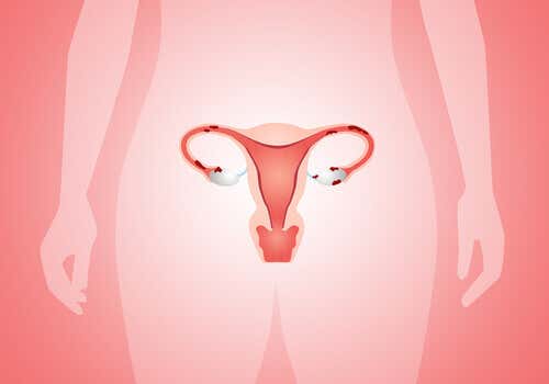 Dispositivos intrateurinos: cáncer de cuello uterino
