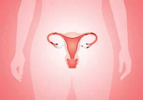Dispositivos intrateurinos: cáncer de cuello uterino