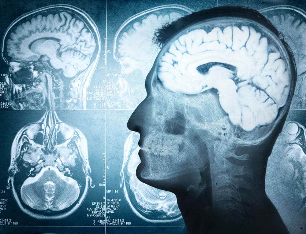 Causas del edema cerebral