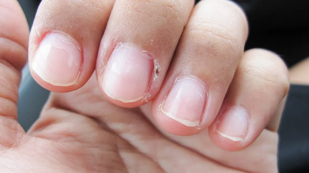 Uñas de las manos.