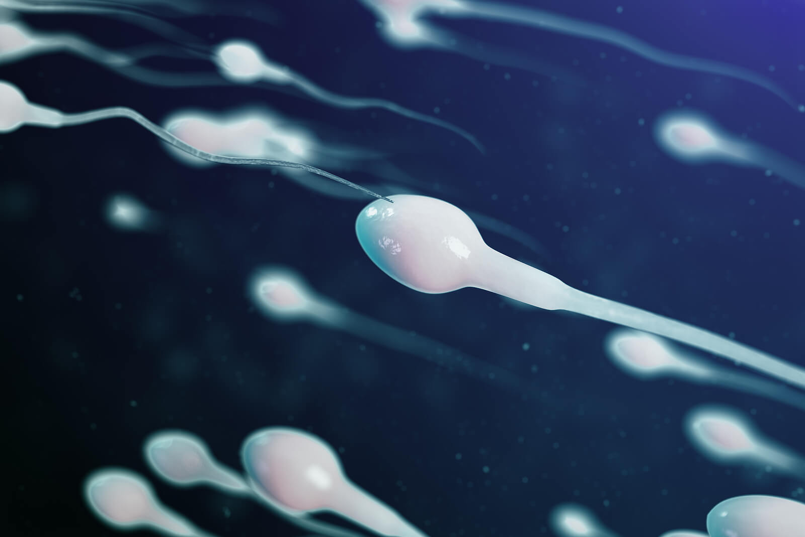 Il nodulo nei testicoli provoca infertilità.