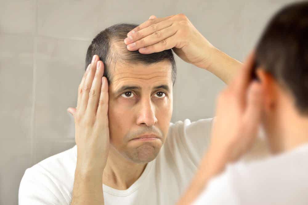 Natürliche Heilmittel für Alopezie - Mann mit dünner werdendem Haar