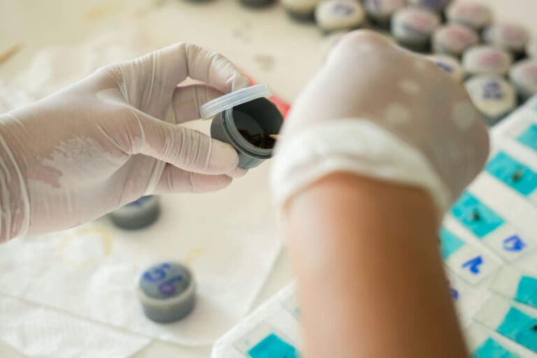 Heces alquitranosas: ¿qué significan?