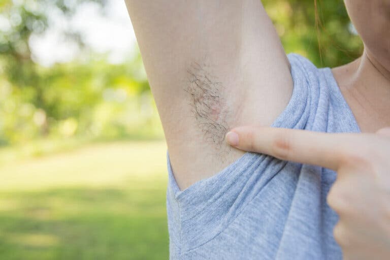 5 consejos para eliminar los vellos encarnados sin dolor