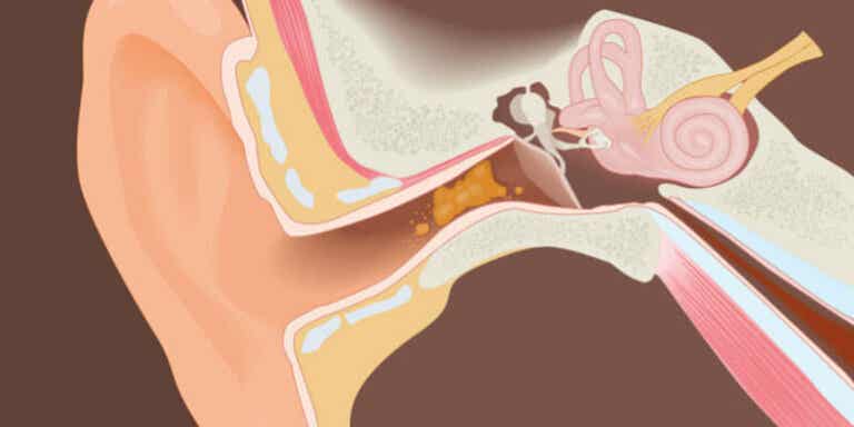 ¿Por qué nuestros oídos producen cera?¿Cómo lo hacen?