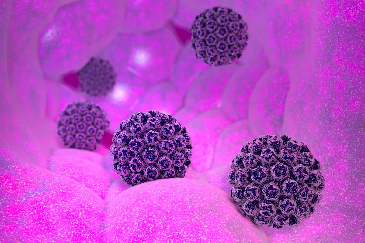Virus que causa gingivoestomatitis en niños.