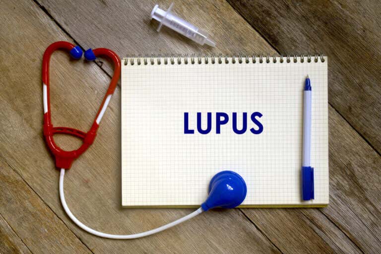 ¿Cuáles son los factores de riesgo del lupus?