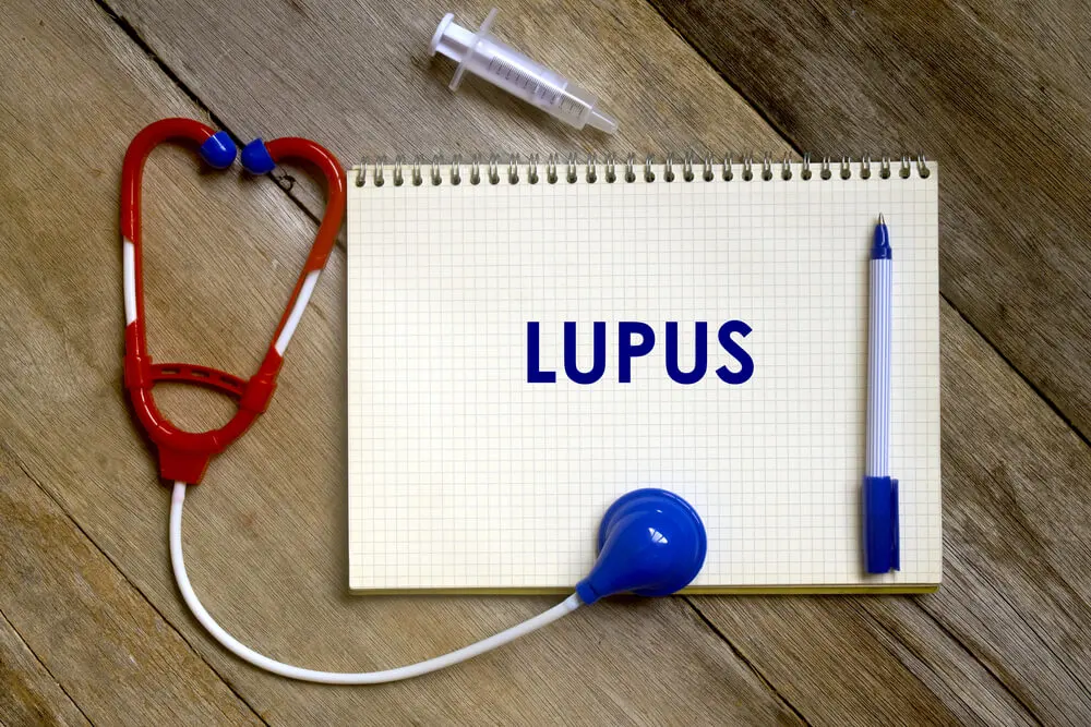 Le lupus.