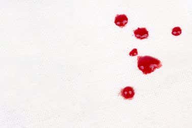 Trucos para quitar manchas de sangre en ropa blanca
