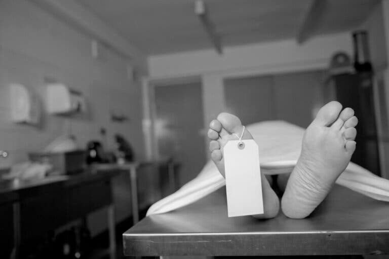 ¿Qué es el rigor mortis?