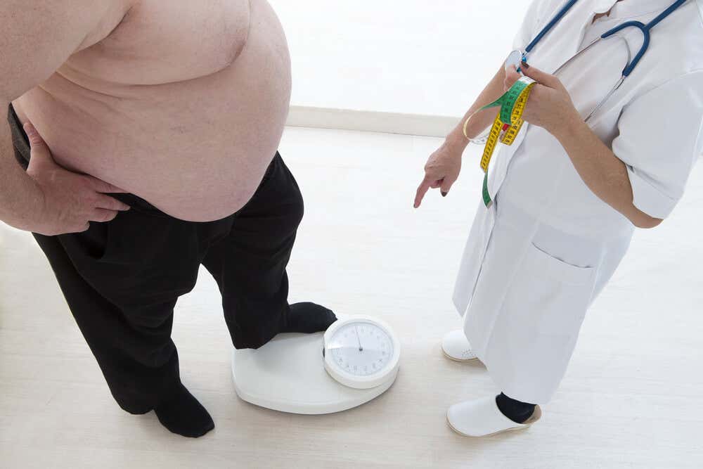 Hombre con obesidad pesándose.