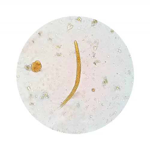 Parásito al microscopio