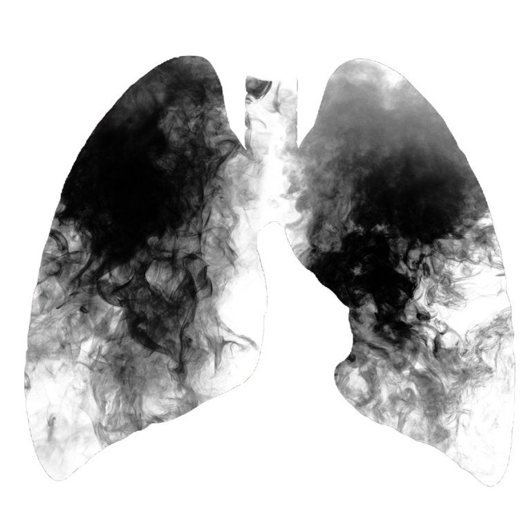 ¿Por qué fumar produce cáncer de pulmón?