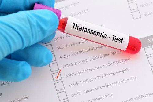 ¿En qué consiste la talasemia?