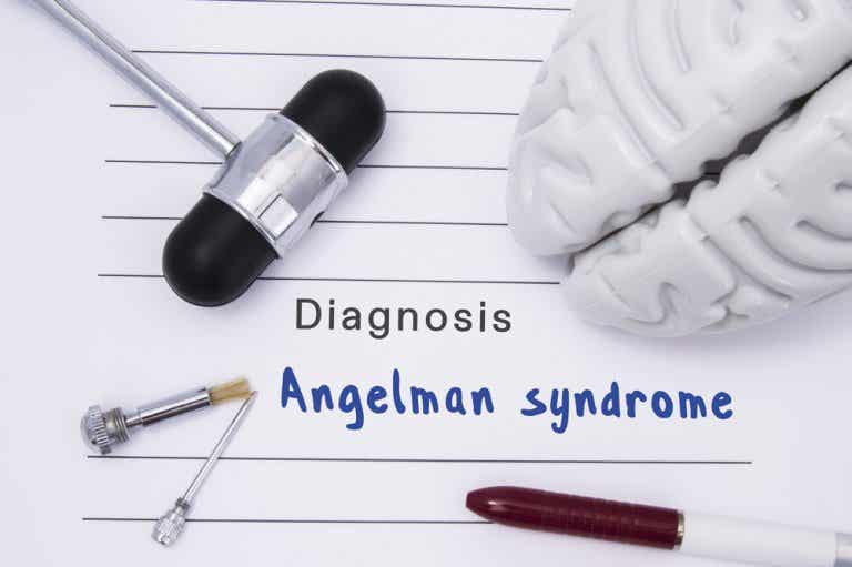 ¿Qué es el síndrome de Angelman?¿Tiene tratamiento?