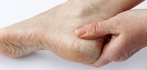 ¿Por qué siempre nos olvidamos de la salud de nuestros pies?