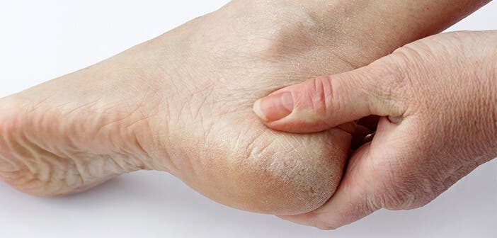 Unos talones suaves son sinónimo de higiene, belleza y salud