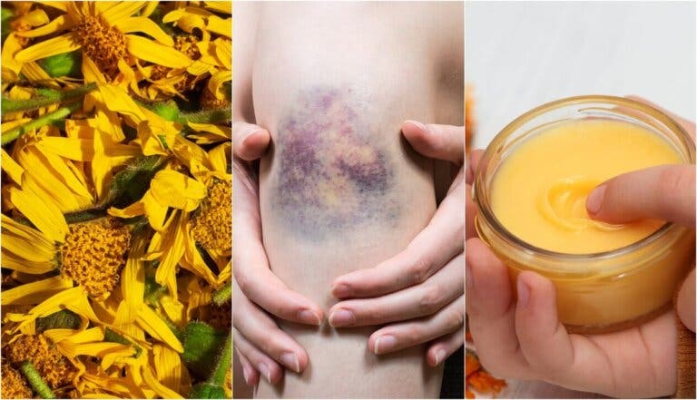 6 usos tópicos del árnica que no sabías