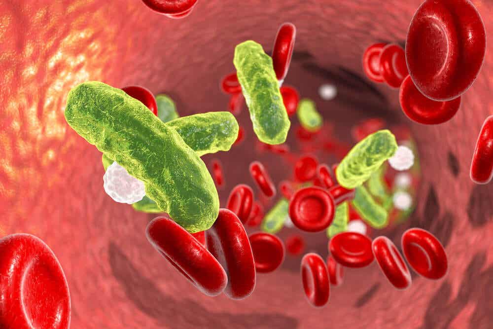 Bacterias en la sangre: infección neonatal