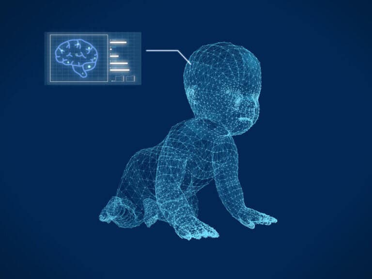 La agenesia del cuerpo calloso del cerebro