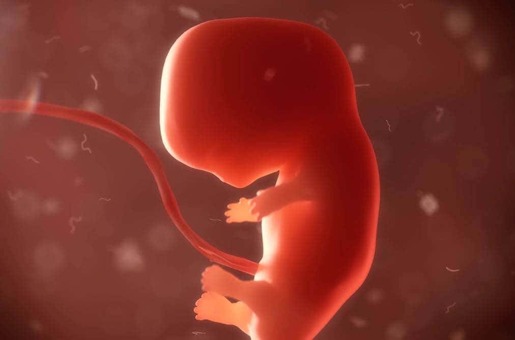 Agenesia del cuerpo calloso cuando el bebé es un embrión