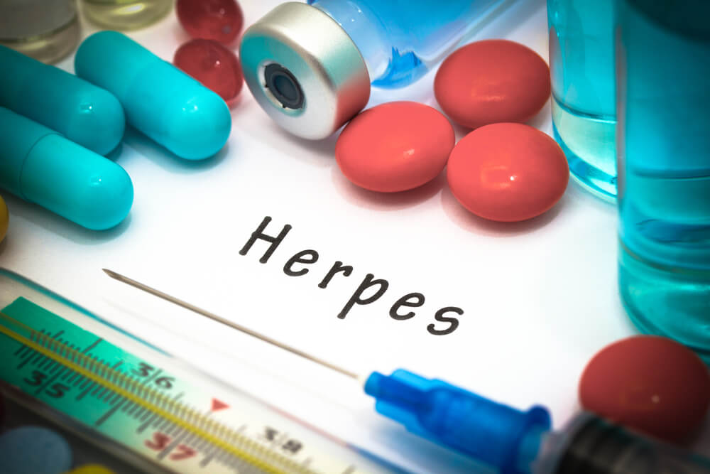 Palabra "herpes" rodeada de material médico.