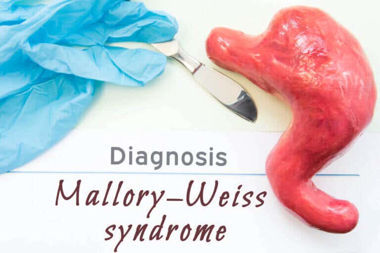 Síndrome de Mallory-Weiss: ¿cuáles son sus síntomas y tratamiento?