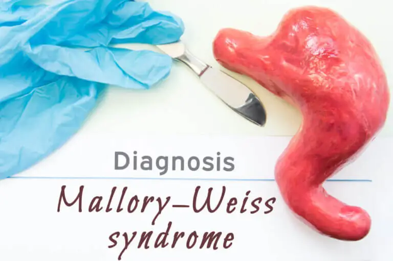 Síndrome de Mallory-Weiss: ¿cuáles son sus síntomas y tratamiento?