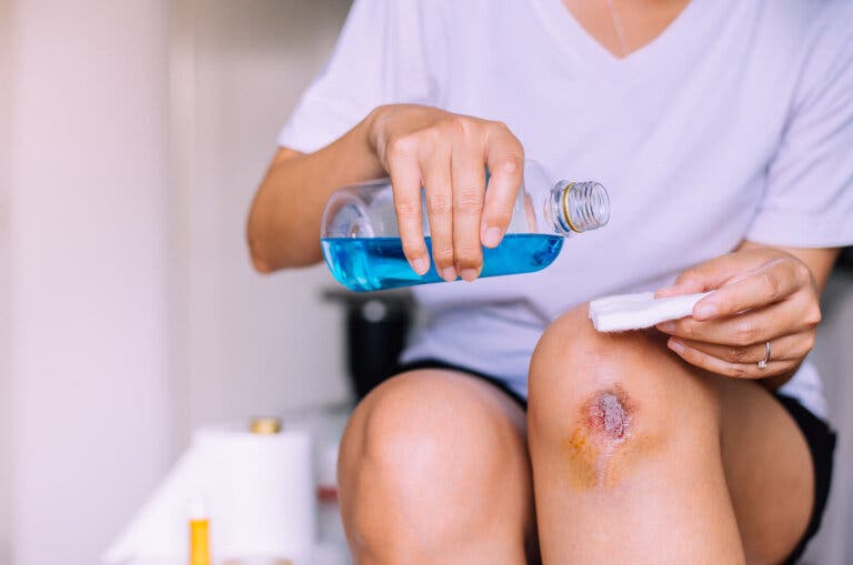 Pasos para curar una herida infectada de forma higiénica