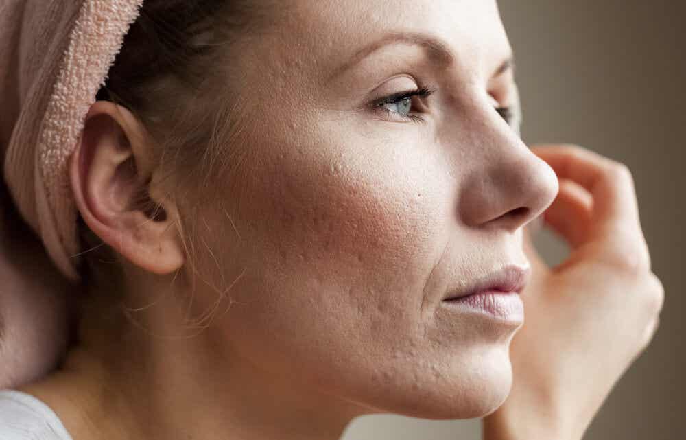 8 consejos para sellar los poros dilatados de tu piel