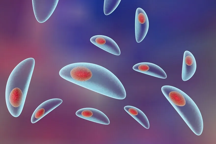 Toxoplasmosis