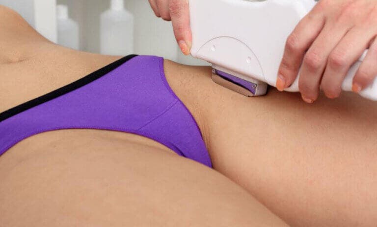 Acerca de la depilación femenina: ¿depilar la zona bikini?