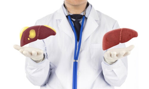 Hígado graso, la enfermedad silenciosa que puede derivar en cáncer