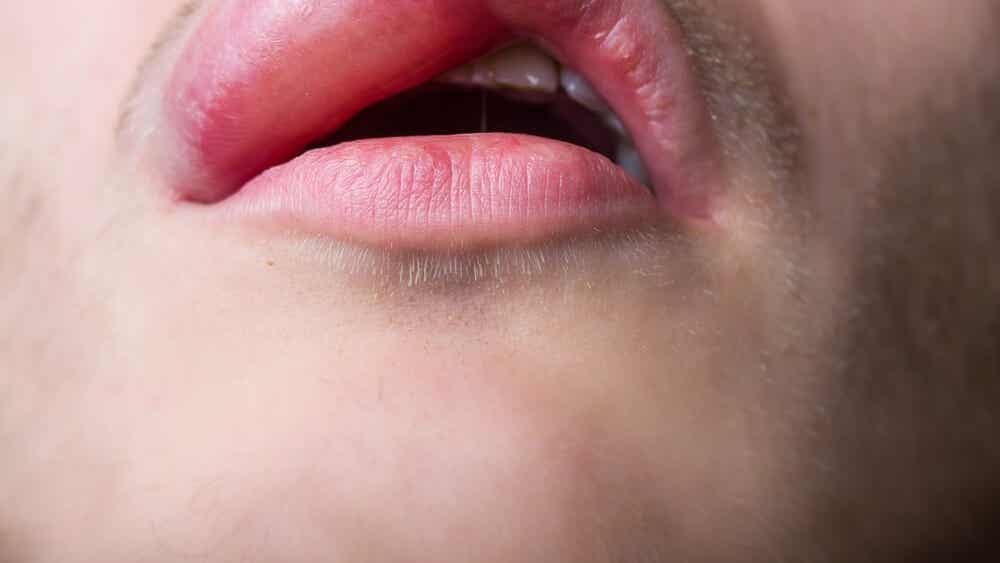 Labios Inchado 12 causas de los labios hinchados - Mejor con Salud